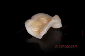Crowns - in onley cyrkon - ZESTAW zdjęć Internet