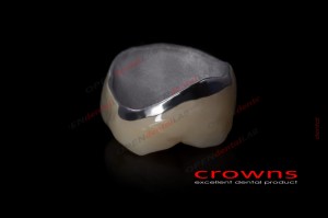 Crowns - korona kompozytowa - 340dpi - zdjęcie 6536