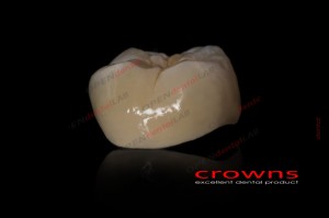 Crowns - korona kompozytowa - 340dpi - zdjęcie 6534
