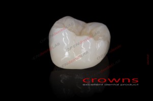 Crowns - korona pełnokonturowa - 340dpi - zdjęcie 3079
