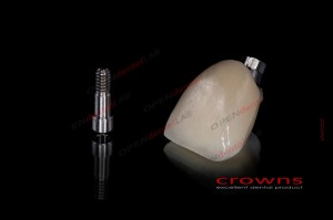Crowns - implanty - all in one - korona - 340dpi - zdjęcie 8280