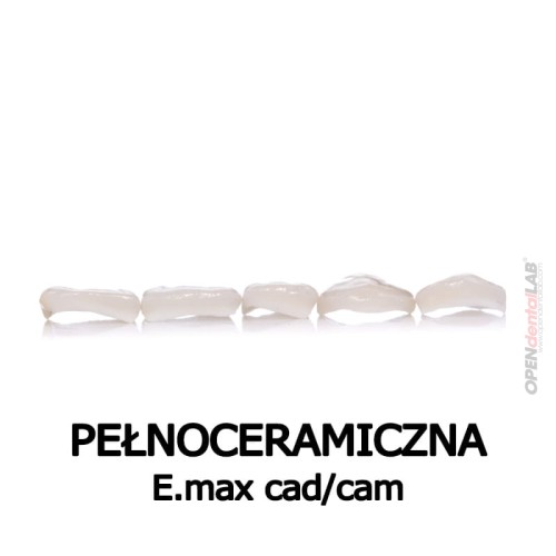 pelnoceramiczna-emax.jpg