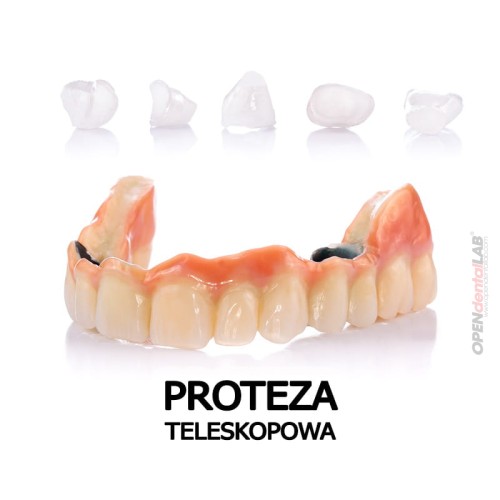 proteza-teleskopowa.jpg