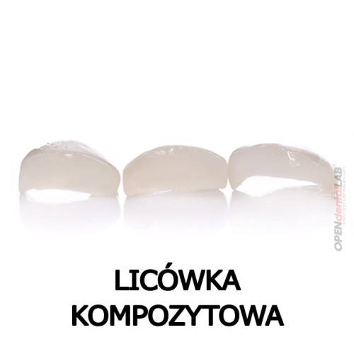 licowka kompozytowa.jpg