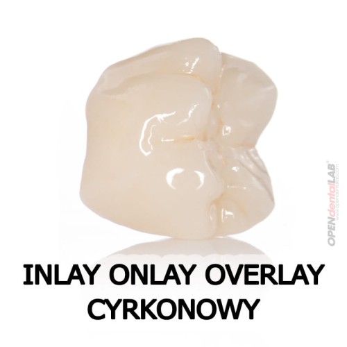 Inlay onlay overlay cyrkonowy.jpg