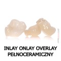 Inlay onlay overlay pełnoceramiczny.jpg