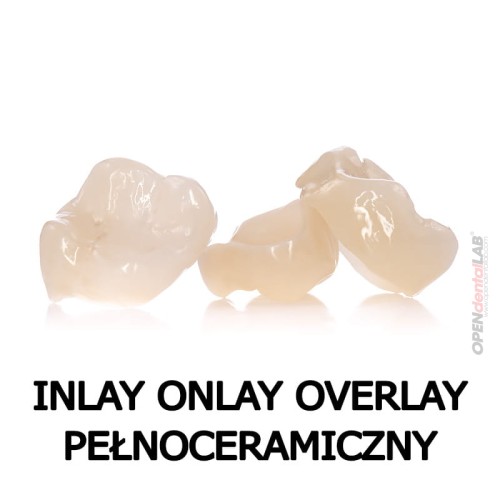 Inlay onlay overlay pełnoceramiczny.jpg