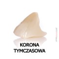 korona tymczasowa.jpg