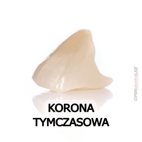 korona tymczasowa.jpg