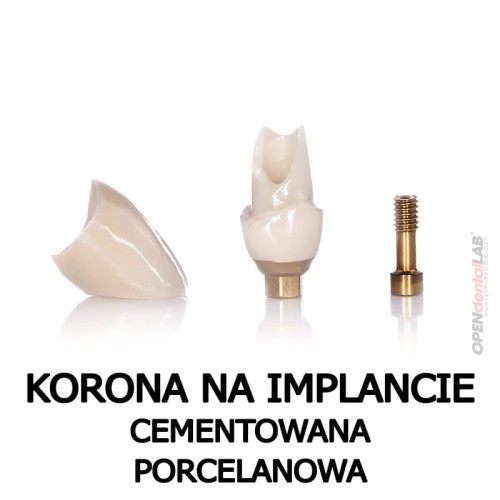 korona na implancie cementowana porcelanowa.jpg