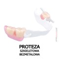proteza  szkieletowa bezmetalowa.jpg