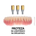 proteza  na lokatorach na implantach.jpg