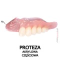 proteza  akrylowa  częściowa.jpg