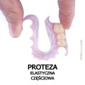 proteza  elastyczna  częściowa.jpg