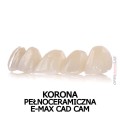 korona  pełnoceramiczna e-max cad cam_.jpg