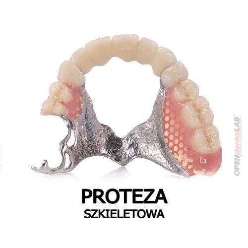 proteza szkieletowa.jpg