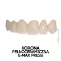 korona  pełnoceramiczna e-max press.jpg