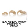 inlay onlay overlay cyrkonowy fx cad cam.jpg