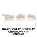 inlay onlay overlay cyrkonowy HT cad cam.jpg