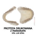 proteza drukowana z markerami góra dół.jpg