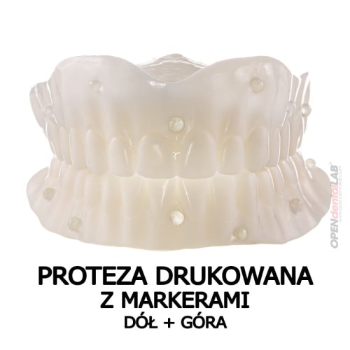 proteza drukowana z markerami góra plus dół.jpg