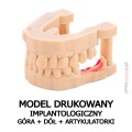 model drukowany_implantologiczny góra dół artykulatorki.jpg