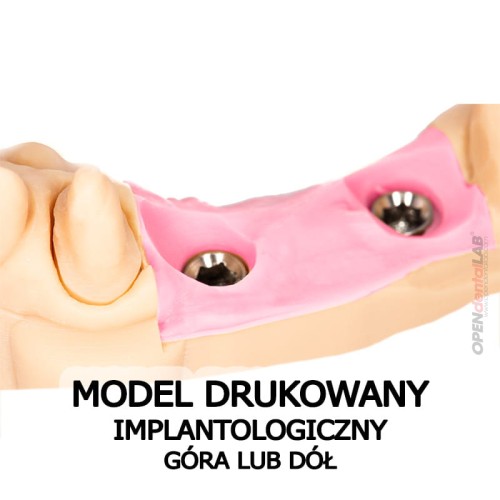 model drukowany_implantologiczny góra dół.jpg