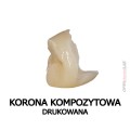 korona kompozytowa drukowana 1.jpg