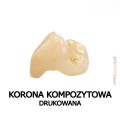 korona kompozytowa drukowana 4.jpg