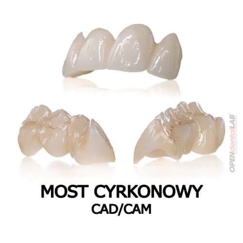 most cyrkonowy cad cam.jpg