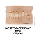 most cyrkonowy tymczasowy PMMA cad cam 3.jpg