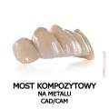 most kompzytowy na metalu cad cam.jpg