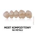 most kompzytowy na metalu.jpg