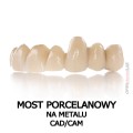 most porcelanowy na metalu cad cam.jpg