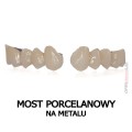 most porcelanowy na metalu.jpg