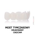 most tymczasowy drukowany cad cam.jpg
