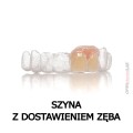 szyna - dostawienie zeba 3.jpg