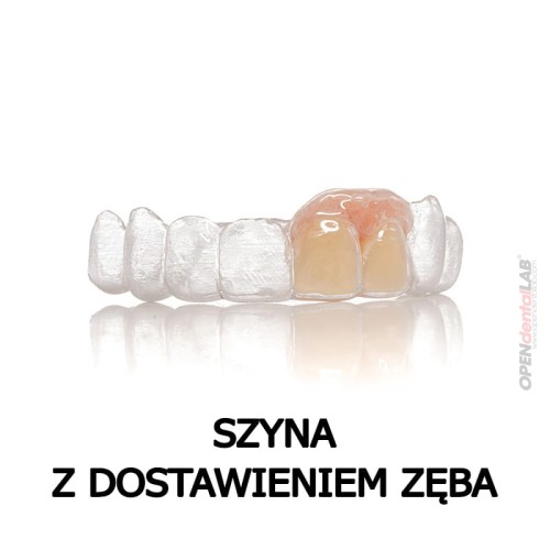 szyna - dostawienie zeba 3.jpg