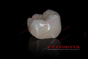 Crowns - korona pełnokonturowa - 340dpi - zdjęcie 3076