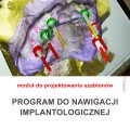 program do nawigacji implantologicznej -4.jpg