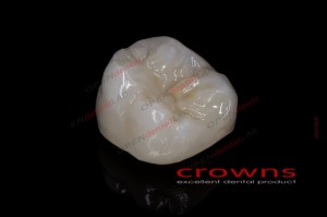 Crowns - korona pełnokonturowa - 340dpi - zdjęcie 3084