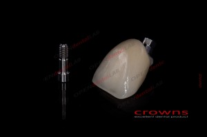 Crowns - implanty - all in one - korona - 340dpi - zdjęcie 8275