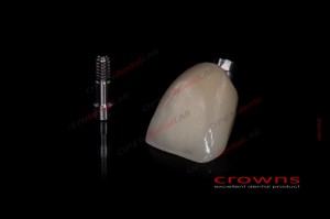 Crowns - implanty - all in one - korona - 340dpi - zdjęcie 8276