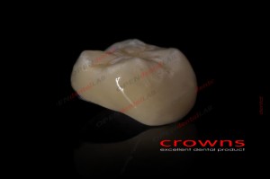 Crowns - korona kompozytowa - 340dpi - zdjęcie 6533
