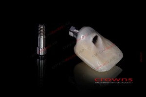 Crowns - implanty - all in one - korona - 340dpi - zdjęcie 8282