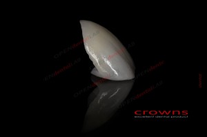 Crowns - licówka press - ZESTAW zdjęć Internet