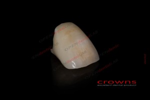 Crowns - korona cyrkonowa - ZESTAW zdjęć Internet