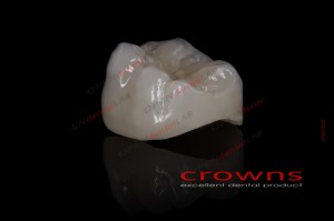 Crowns - korona pełnokonturowa - 340dpi - zdjęcie 3072