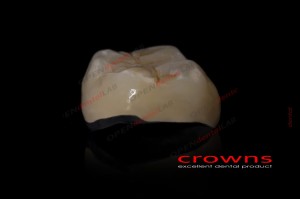 Crowns - korona kompozytowa - 340dpi - zdjęcie 6532