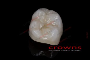 Crowns - korona pełnokonturowa - 300dpi - zdjęcie 3083